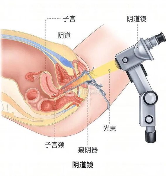 深圳推出免费宫颈癌筛查公益项目，健康关爱不容错过
