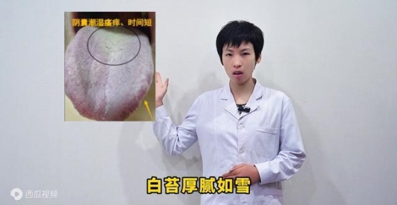 舌象透视：探寻虚寒湿热背后的真实病因及调理方法